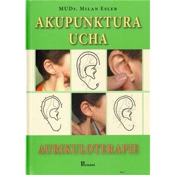 Akupunktura ucha