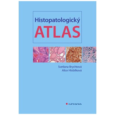 Histopatologický atlas - Brychtová Svetlana, Hlobilková Alice – Zboží Mobilmania