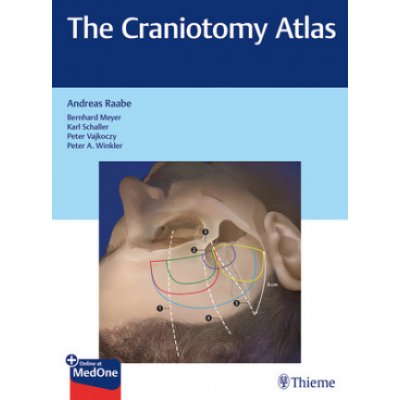 Craniotomy Atlas – Zboží Mobilmania