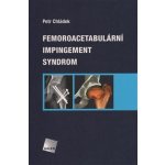 Femoroacetabulární impingement syndrom – Sleviste.cz