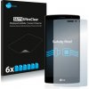Ochranná fólie pro mobilní telefon 6x SU75 UltraClear Screen Protector LG G4s