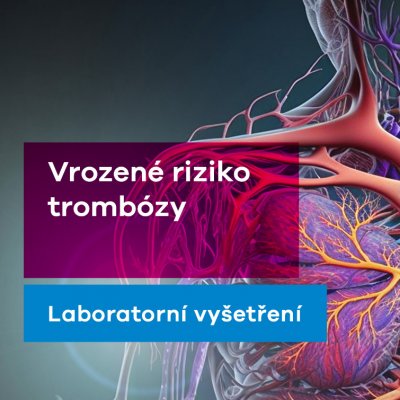 EUC Laboratoře test na riziko trombózy – Zbozi.Blesk.cz