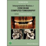 Interpretation Basics of Cone Beam Computed Tomography