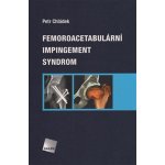 Femoroacetabul ární impingement syndrom – Sleviste.cz