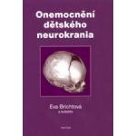 Onemocnění dětského neurokrania - Eva Brichtová – Hledejceny.cz