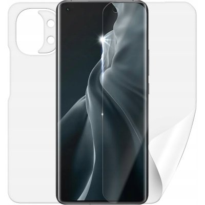 Ochranná fólie Screenshield Xiaomi Mi 11 – Sleviste.cz
