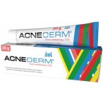 Unia Acne Derm krém proti akné 20 g – Hledejceny.cz