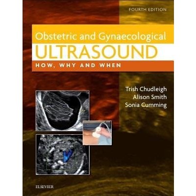 Obstetric a Gynaecological Ultrasound – Hledejceny.cz