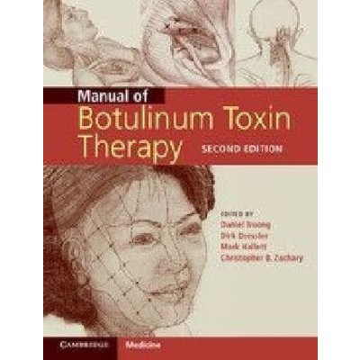 Manual of Botulinum Toxin Therapy – Zbozi.Blesk.cz