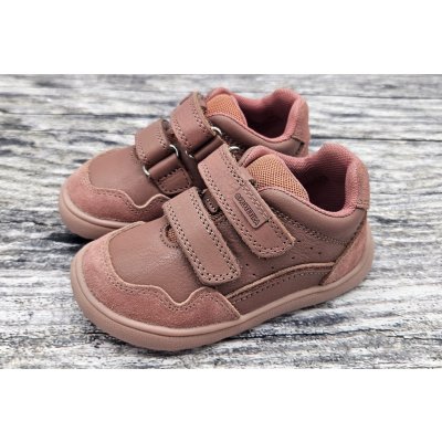 Protetika Ana dark pink – Hledejceny.cz