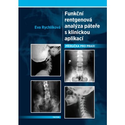 Funkční rentgenová analýza páteře s klinickou aplikací - Eva Rychlíková – Hledejceny.cz