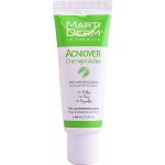 Martiderm Acniover aktivní krém pro aknózní pleť 40 ml – Sleviste.cz