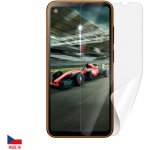 Ochranná fólie ScreenShield IGET Blackview GBL5000 - displej – Zbozi.Blesk.cz