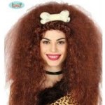 Kost se sponou do vlasů – Sleviste.cz