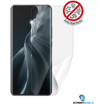 Ochranná fólie Screenshield XIAOMI Mi 11 - displej