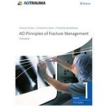 AO Principles of Fracture Management Apivatthakakul TheerachaiPevná vazba – Zbozi.Blesk.cz