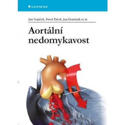 Aortální nedomykavost - Vojáček Jan, Žáček Pavel, Dominik Jan a kolektiv