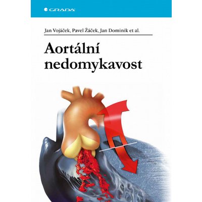 Aortální nedomykavost – Zboží Mobilmania