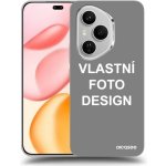 Picasee Ultimate Case pro Honor 400 Pro 5G - Vlastní design/motiv – Sleviste.cz