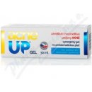 AcneUP Gel na akné a problematickou pleť 30 ml