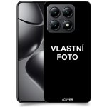 Acover Kryt na mobil Xiaomi 14T Pro s vlastní fotkou / motivem – Zbozi.Blesk.cz