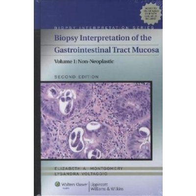 Biopsy Interpretation of the Gastrointestinal Tract Mucosa – Hledejceny.cz