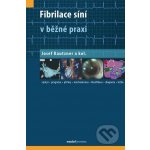 Fibrilace síní v běžné praxi – Hledejceny.cz