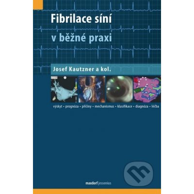 Fibrilace síní v běžné praxi – Hledejceny.cz