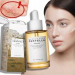SKIN1004 Madagascar Centella Ampoule s pupečníkem asijským 55 ml – Zboží Dáma