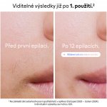 Braun Smart IPL Skin I·Expert PL7147 – Zbozi.Blesk.cz