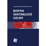 Biopsie sentinelové uzliny - Tomáš Bohanes, Čestmír Neoral – Hledejceny.cz
