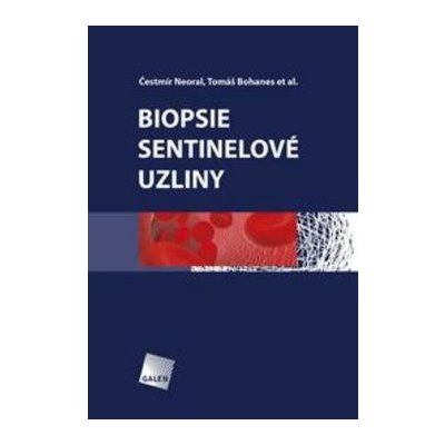 Biopsie sentinelové uzliny - Tomáš Bohanes, Čestmír Neoral – Sleviste.cz