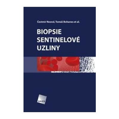 Biopsie sentinelové uzliny - Tomáš Bohanes, Čestmír Neoral – Hledejceny.cz