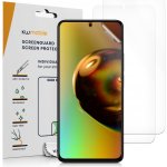 Ochranná folie kwmobile pro Xiaomi Redmi Note 11 / Note 11S 3x – Zboží Živě