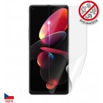 Ochranná fólie Screenshield CUBOT Max 3 - displej – Zbozi.Blesk.cz