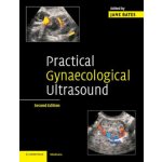 Practical Gynaecological Ultrasound – Hledejceny.cz