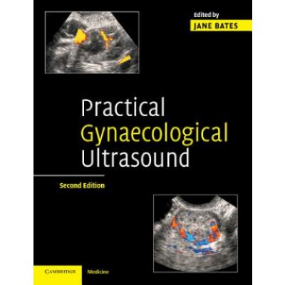 Practical Gynaecological Ultrasound – Hledejceny.cz