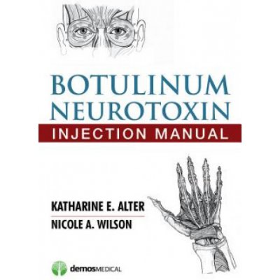 Botulinum Neurotoxin Injection Manual – Zbozi.Blesk.cz