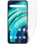 Ochranná fólie Screenshield UMIDIGI A9 Plus - displej – Zbozi.Blesk.cz