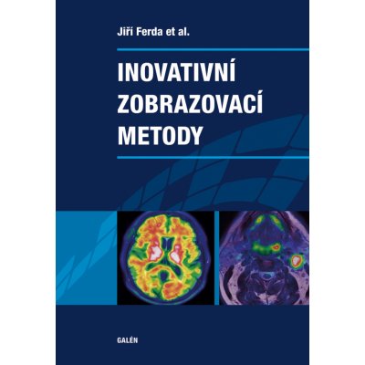 Inovativní zobrazovací metody – Zboží Mobilmania