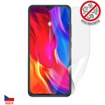 Ochranná fólie Screenshield CUBOT Note 7 - displej – Zboží Mobilmania