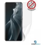 Ochranná fólie Screenshield Xiaomi Mi 11 – Sleviste.cz