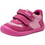 Protetika Melania Fuxia – Sleviste.cz