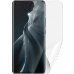 Ochranná fólie Screenshield Xiaomi Mi 11 – Zbozi.Blesk.cz