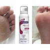 Péče o nohy Footlogix Rough Skin Formula Pěna na velmi hrubou pokožku 125 ml