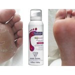 Footlogix Rough Skin Formula Pěna na velmi hrubou pokožku 125 ml – Zbozi.Blesk.cz