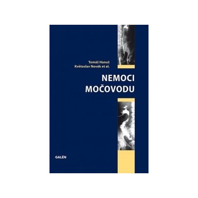 Nemoci močovodu – Hledejceny.cz