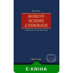 Mozkové ischemie a hemoragie - Kalvach Pavel, kolektiv – Hledejceny.cz