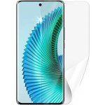 Ochranná fólie Screenshield Huawei Honor Magic 6 Lite 5G - displej – Zboží Živě