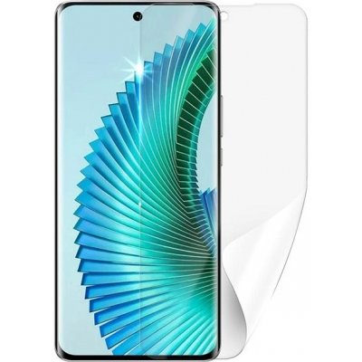 Ochranná fólie Screenshield Huawei Honor Magic 6 Lite 5G - displej – Zboží Mobilmania